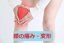 膝の痛み・変形性膝関節症の施術