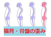猫背・骨盤矯正の施術